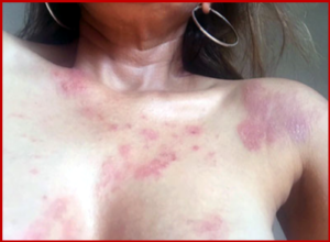 AutoInformed.com on American Airlines toxic uniforms